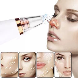 Succionador de poros - Vélya